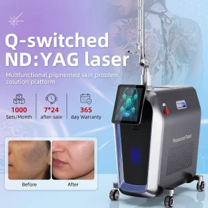350 Ps Pico Laser Nd YAG Q Tattoo Removal for All Color Pico Laser Machine Unlimited Shot