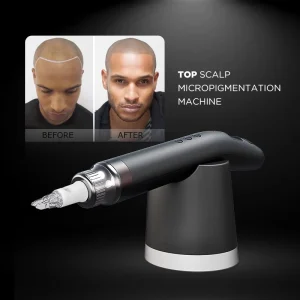 Customizable Logo Electric Tattoo Kits Rechargeable Automated Scalp Micropigmentation SMP Machine foe Scalp Headline