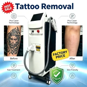 Equipment for Beauty Clinic Vertical Picosecond NdYag Laser Pigment Freckle Scar Removal Tattoo Machine