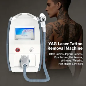 Factory Direct Triple Wavelength Q Switched Nd YAG Laser Tattoo Removal Spot Pigment Elimination Skin Rejuvenation Equipment