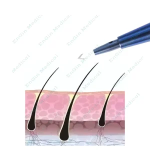 Hair Transplant Sapphire Hair Blade Knife Sapphire Blade Hair Titanium Handle for Sapphire Blades