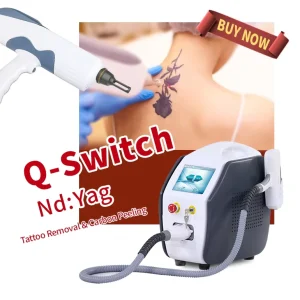 High Frequency 1064 nm 532nm and 1320nm Q Switch Nd Yag Tattoo Removal Machine Laser