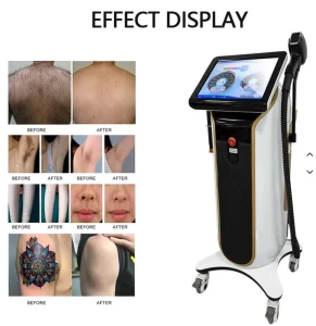 High Power Diode Laser 2 in 1 Tattoo Picosecond Diode Laser Hair Removal Machine Beauty Salon Equipment