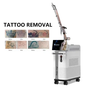 Laser Tattoo Removal Machine 10Hz Pico Laser 4 Wavelengths Picosecond Laser for Aesthetics