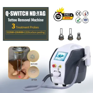 Mini 1064 532 585 650 Q Switch Nd Yag Laser Machine Professional Painless Tattoo Removal Machine Price
