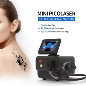 Mini Q Switch Laser Nd Yag Tattoo Removal Carbon Peeling Laser Facial Peeling Machine