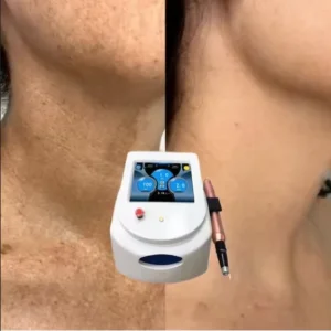 Nd YAG Laser Tattoo Removal Pigment Treatment Carbon Peel Pico Laser Skin Whitening Freckle Removal Stationary Desktop Machine