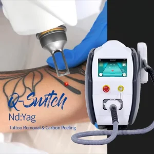 NdYag Q Switched Laser Portable Commercial Use Beauty Equipment for Acne & Tattoo Removal