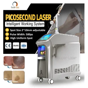 Picosecond Nd Yag Laser Tattoo Removal Machine Painless Melasma Chloasma Treatment Portable 1064nm 532nm