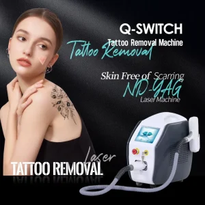 Q Switch Tattoo Removal Machine 10 Hz NdYag Laser Portable 1 Year Warranty for Salon